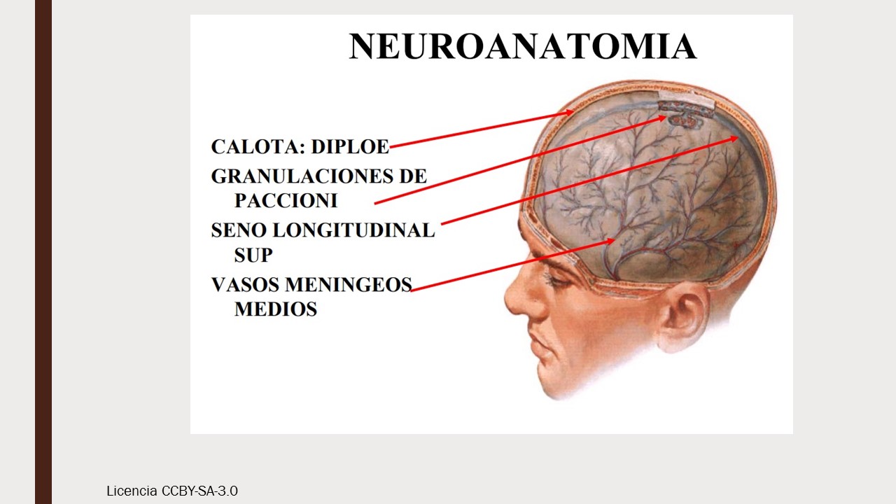 hipoplasia agenesia del cuerpo calloso